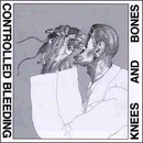 Controlled Bleeding: Knees and Bones
